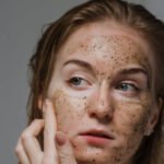 acne_tips_proven_healthhyme