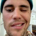 RHS Justin Bieber Healthhyme