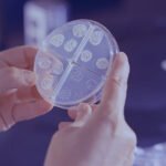 Tuberculosis Treatment Symptoms Causes Healthhyme
