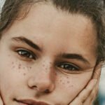 Acne Treatment Options Healthhyme
