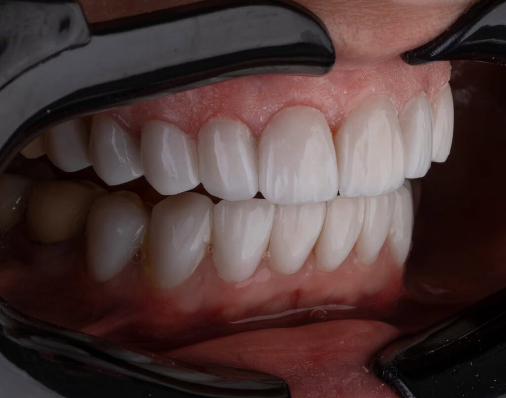 Teeth