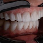Teeth
