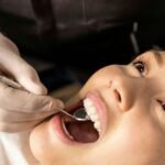 Tooth Sensitivity